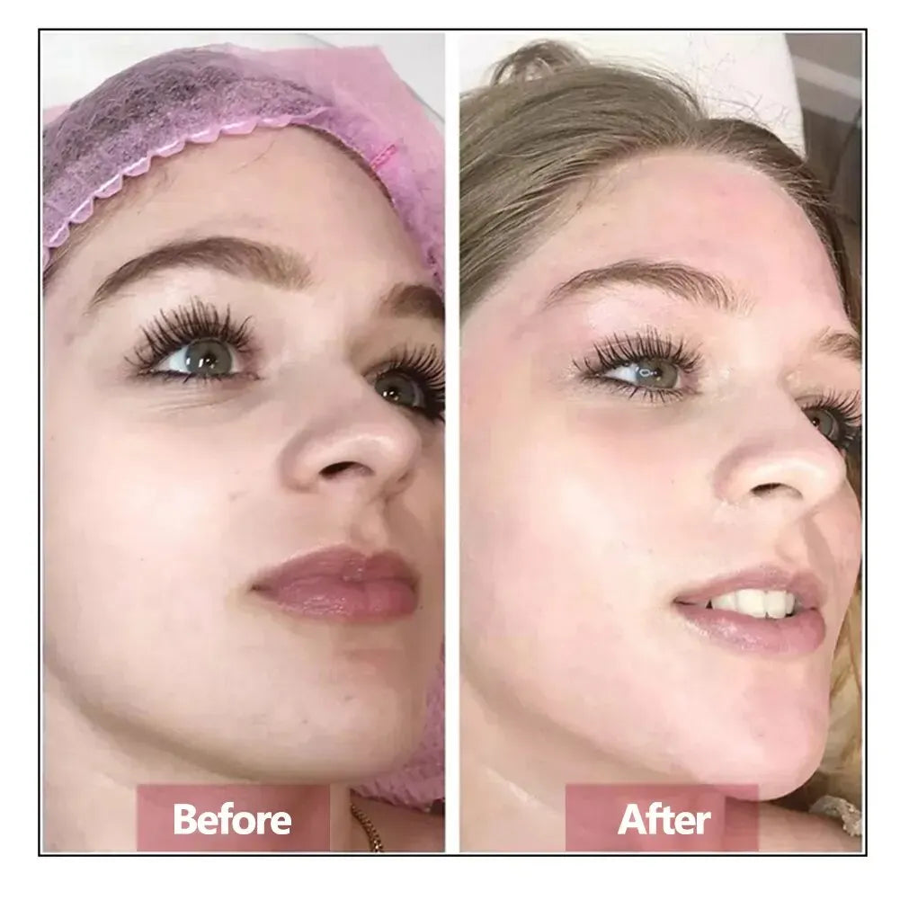 Hyaluronic Acid Anti-Ageing Face Serum — Firming & Rejuvenating