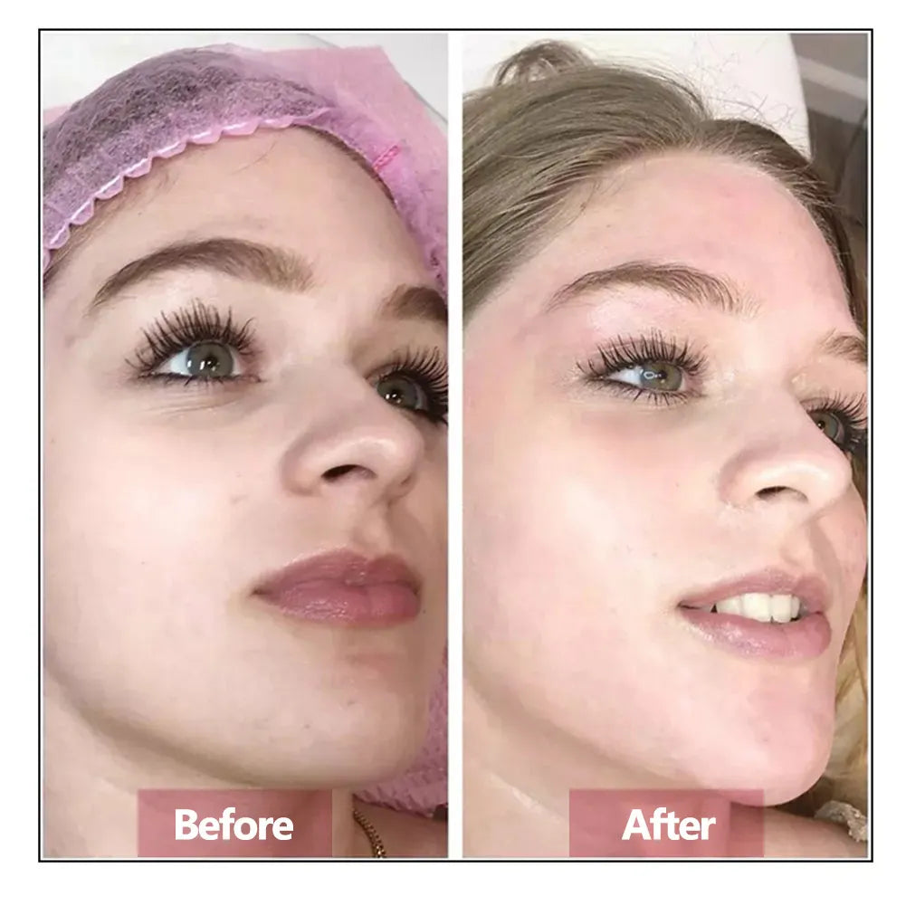 Hyaluronic Acid Anti-Ageing Face Serum — Firming & Rejuvenating