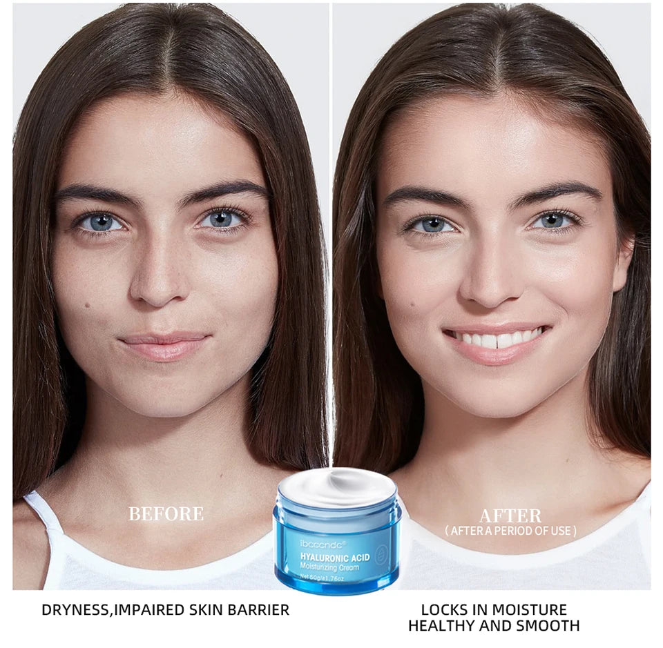 Hyaluronic Acid Gel Cream — Deep Hydration Face Moisturiser