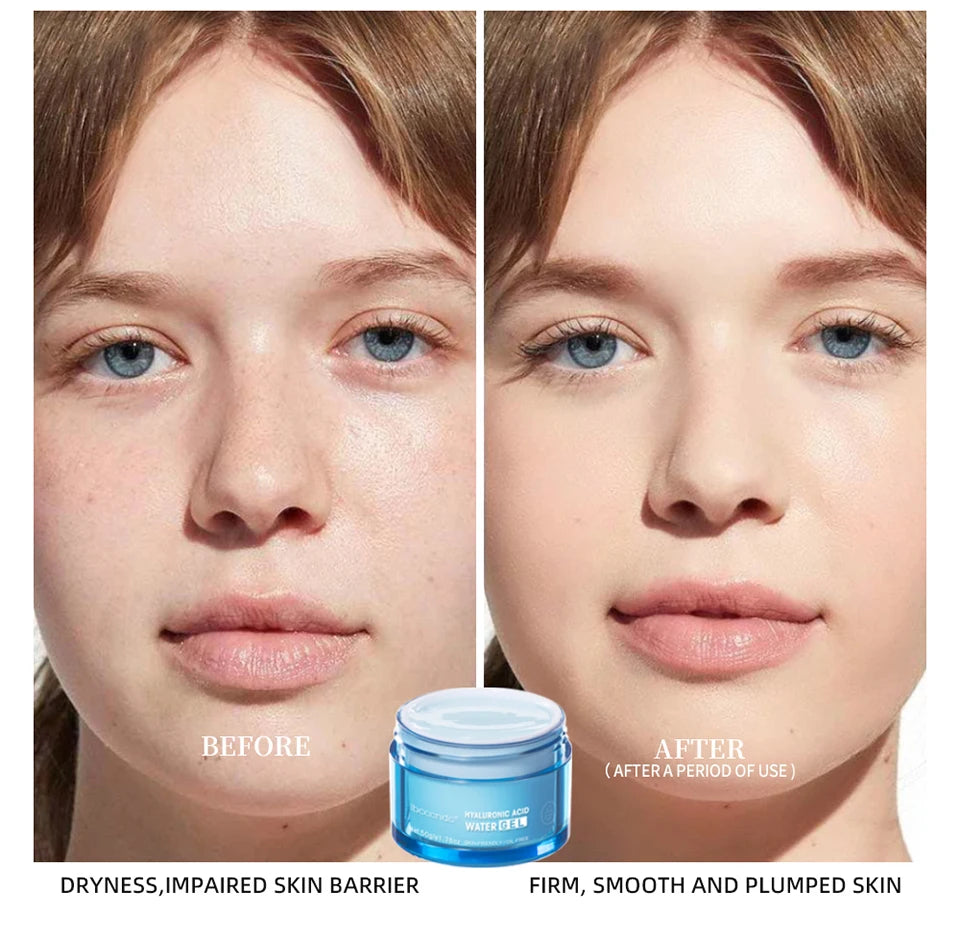 Hyaluronic Acid Gel Cream — Deep Hydration Face Moisturiser