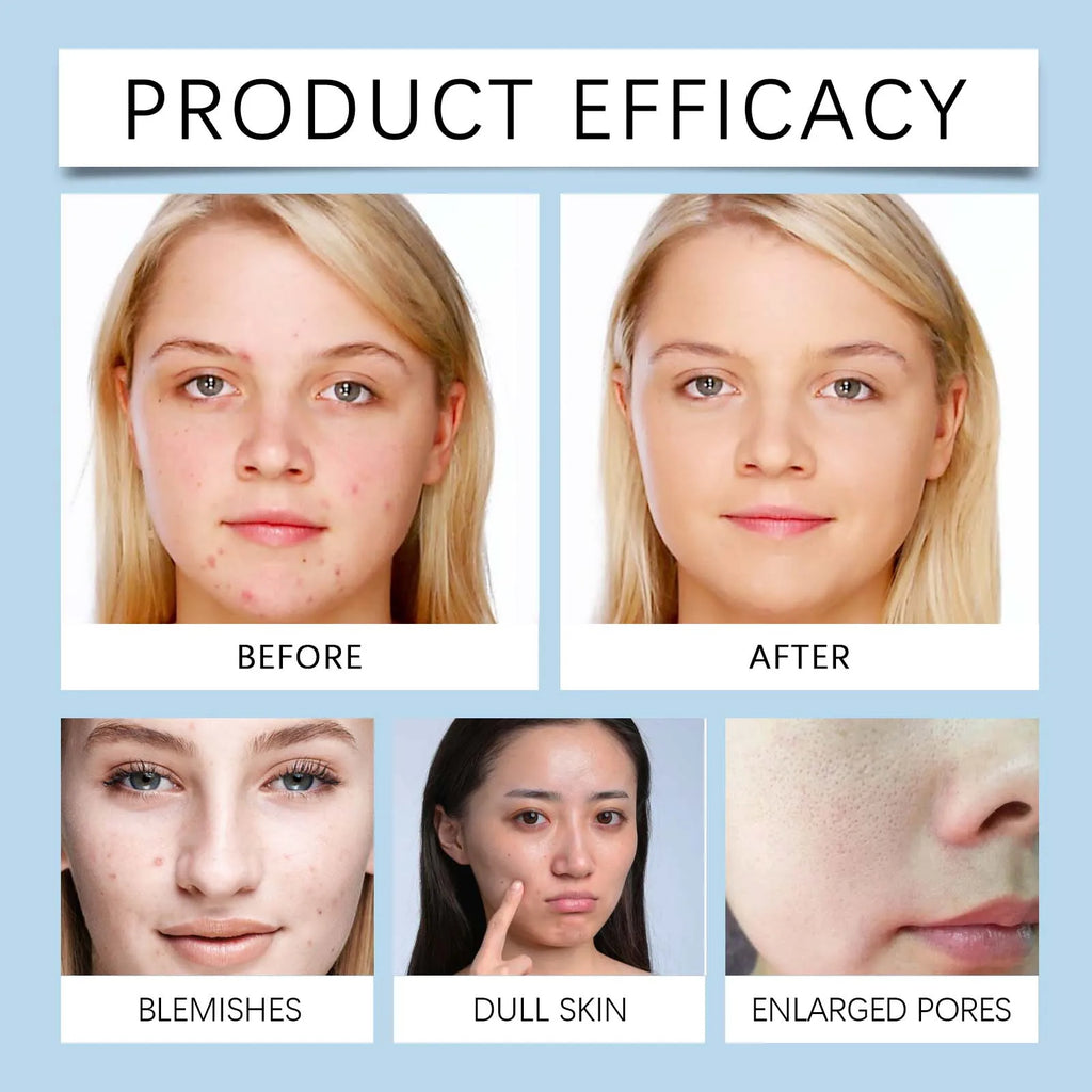 Deep Hydration Korean Facial Cleanser Set